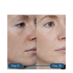 Elemis Dynamic Resurfacing Super-C Serum -Purely Radiant Dynamic Resurfacing Super C Serum add4 68640 982 general