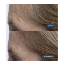 Elemis Pro-Collagen Morning Matrix -Purely Radiant Pro Collagen Morning Matrix add3 68647 2838 general